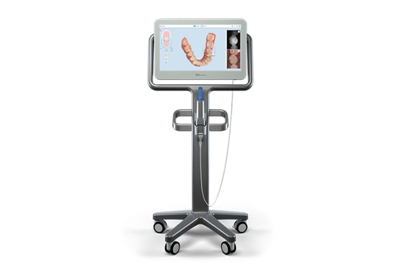 Itero Intra-Oral Scanner in Baltimore
